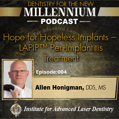 Hope for Hopeless Implants – LAPIP™ Peri-Implantitis Treatment